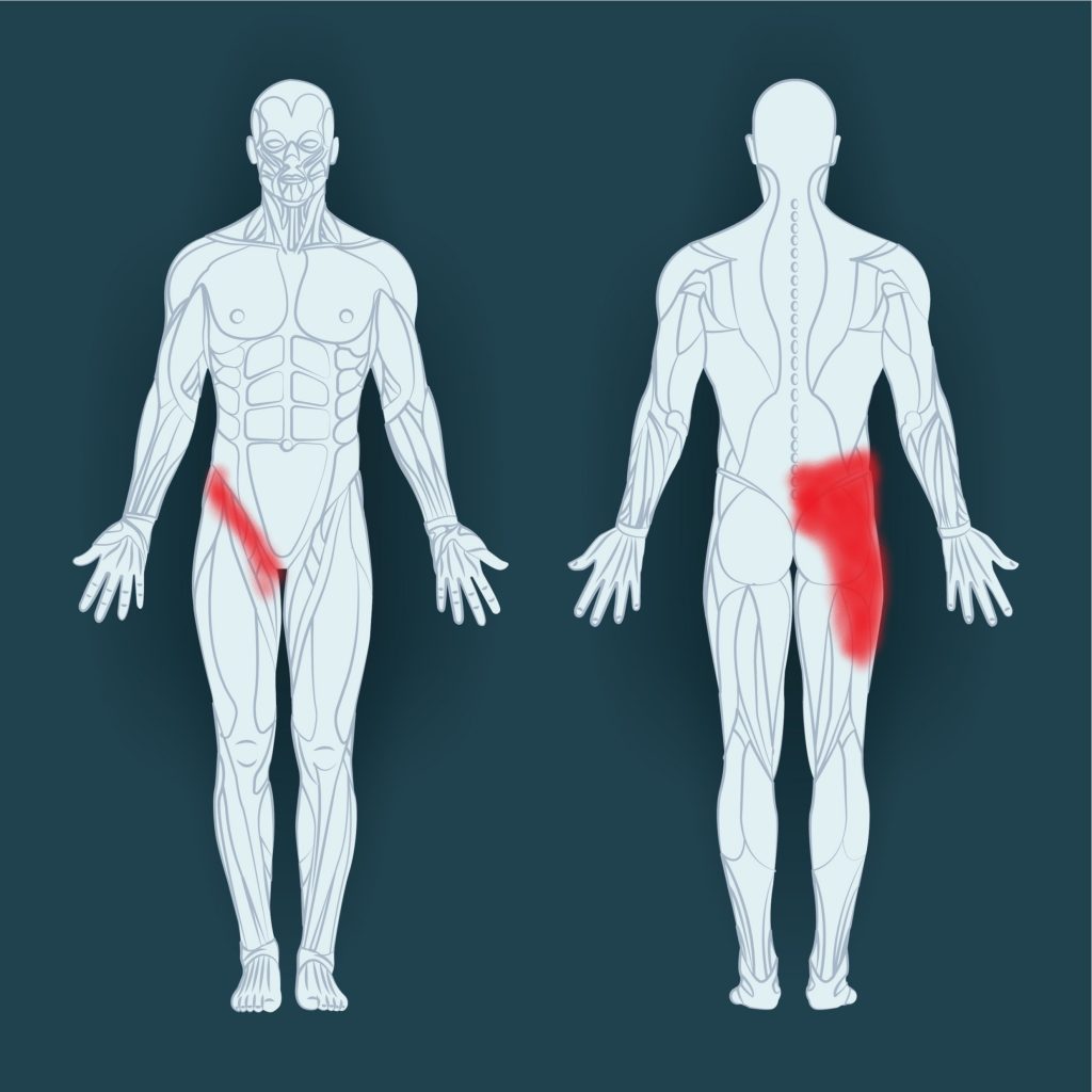 Common Groin Injuries My Family Physio