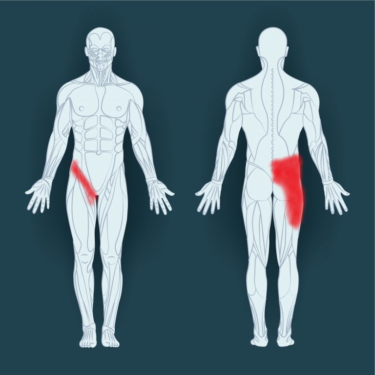 Shooting Pain In Left Hip And Groin