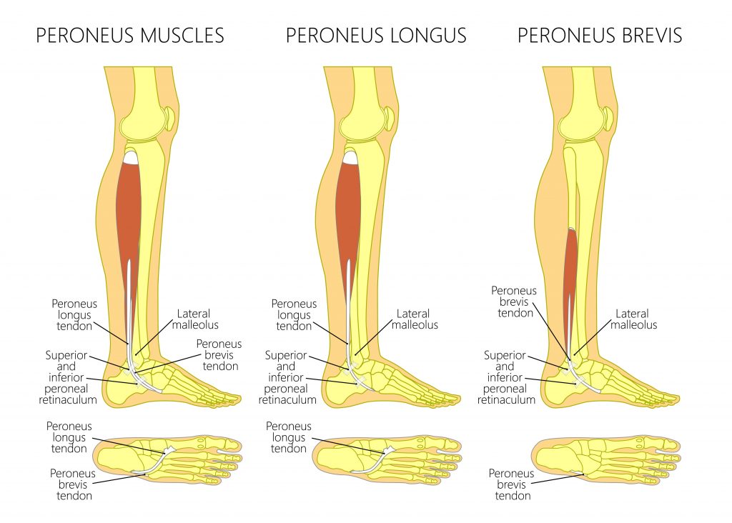 Common Lower Leg and Calf Injuries - My Family Physio
