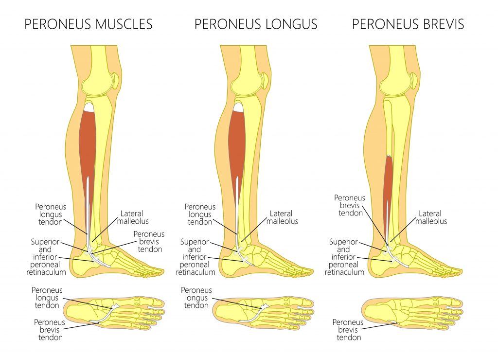 Calf Muscle Strain, Lower Extremity