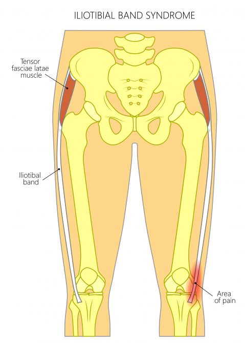 Why Does My Thigh Bone Hurt