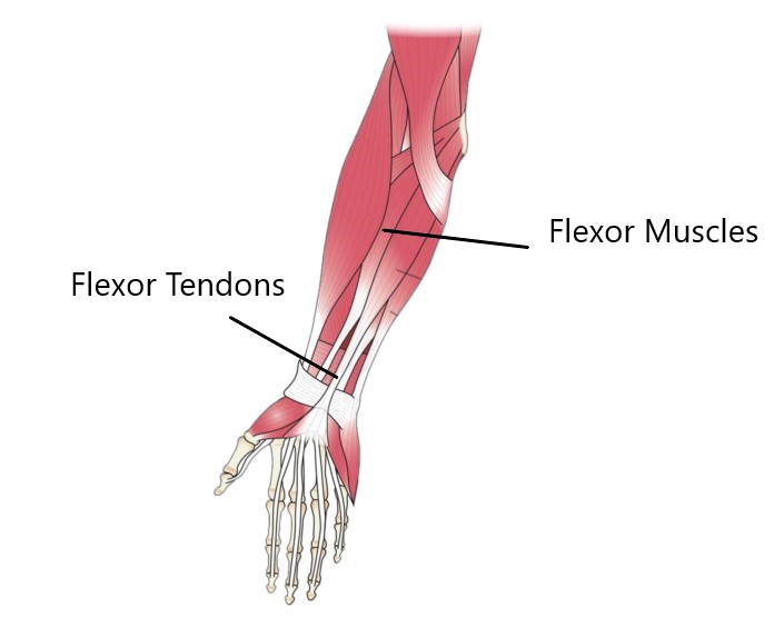 Carpal Tunnel Syndrome - My Family Physio