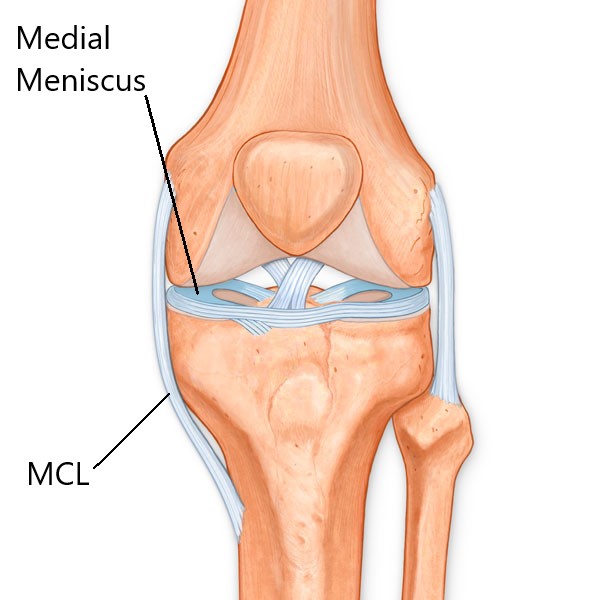 What Is A Knee Mcl