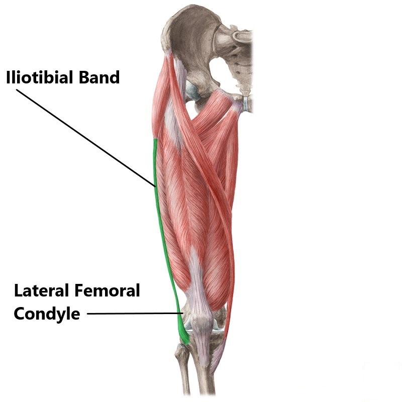 ITB (Iliotibial Band) Syndrome - My Family Physio