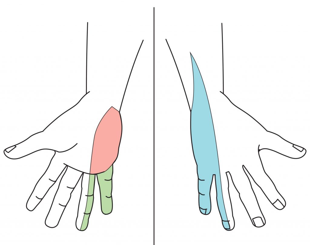 Cubital Tunnel Nerve Glides