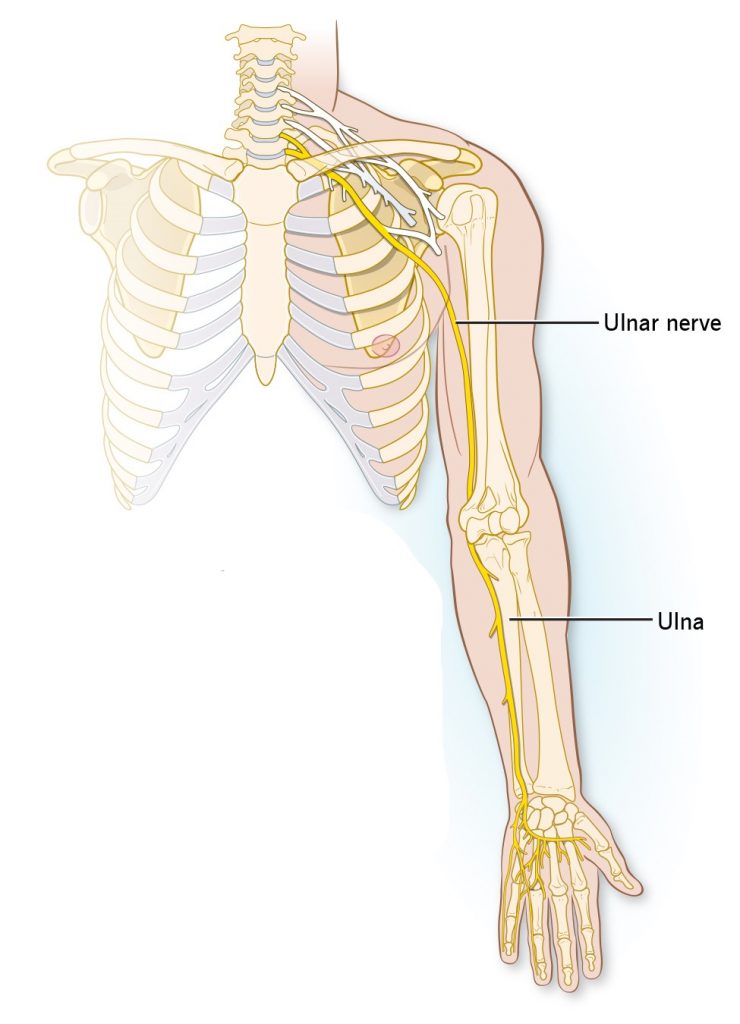 Cubital Tunnel Syndrome - My Family Physio