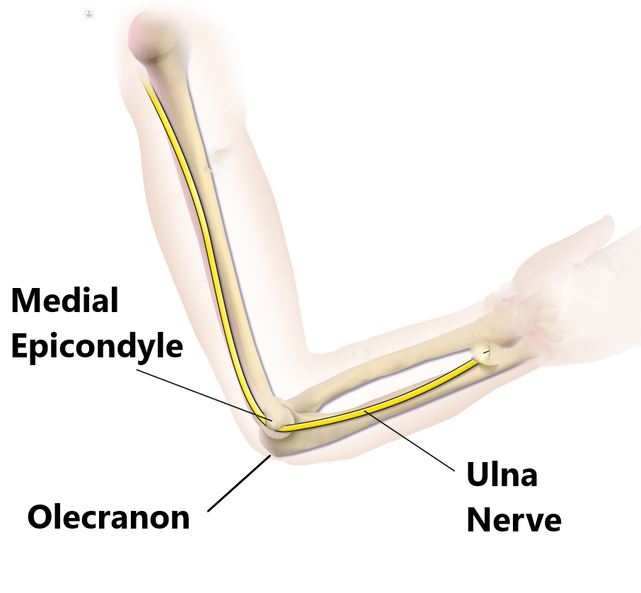 Cubital Tunnel Syndrome - My Family Physio