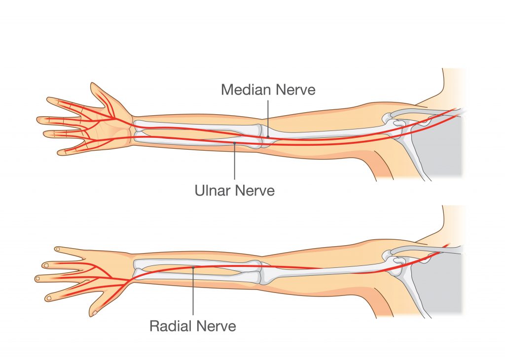 Management of Pins and Needles and Numbness in the Upper Limbs and