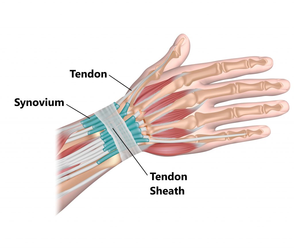 De Quervain's Tenosynovitis - My Family Physio