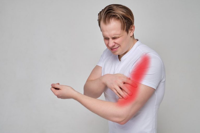 Biceps Tendon Injuries - My Family Physio