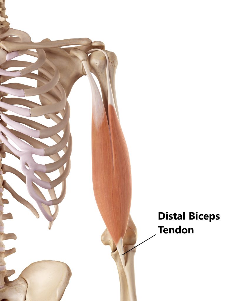 Biceps Tendon Injuries - My Family Physio