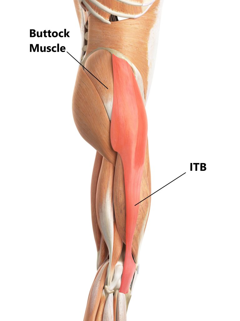 What is Greater Trochanteric Pain Syndrome (GTPS)?