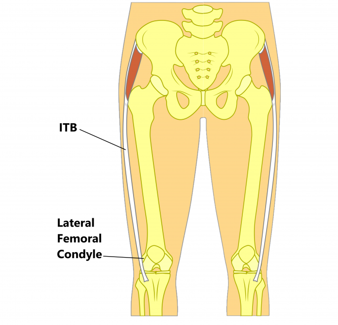 ITB (Iliotibial Band) Syndrome - My Family Physio