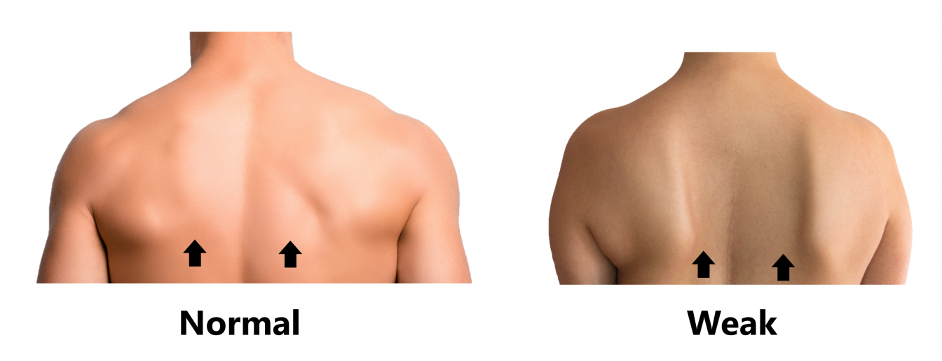 Scapula Stability My Family Physio