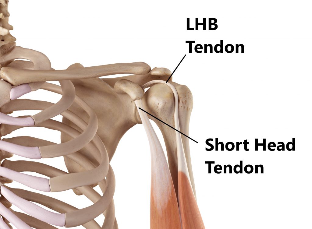 Biceps Tendon Injuries - My Family Physio