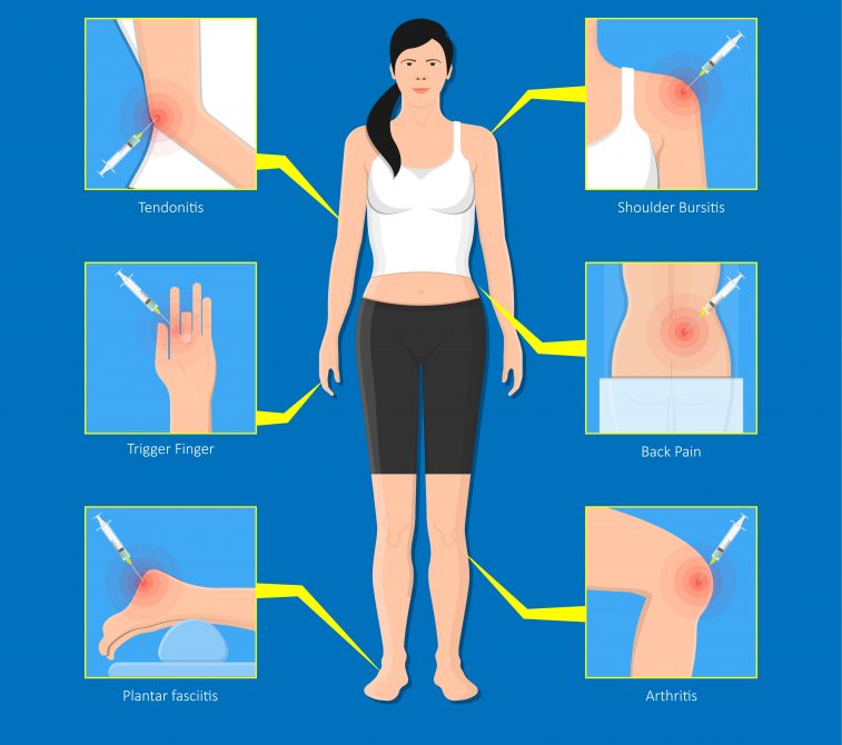 cortisone-injections-my-family-physio