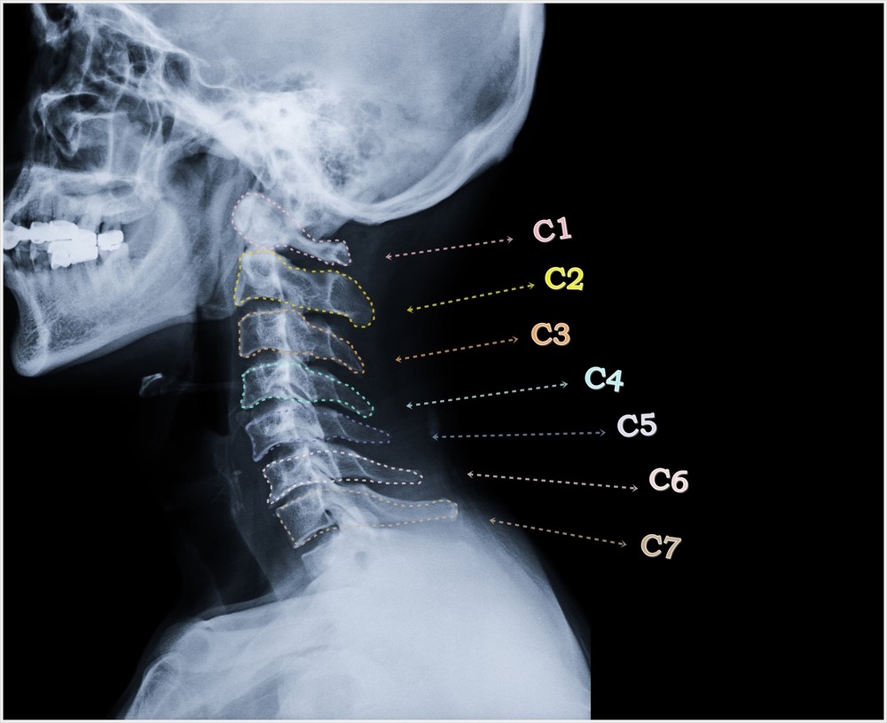 x ray odogs cervical spine