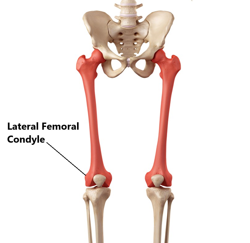 lateral femoral condyle