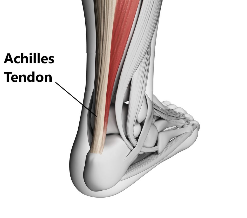 large achilles tendon