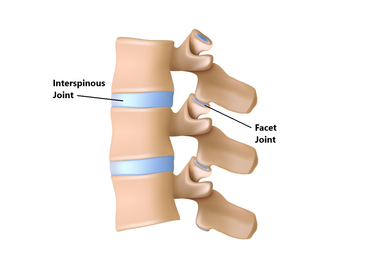Facet Joint Injuries My Family Physio