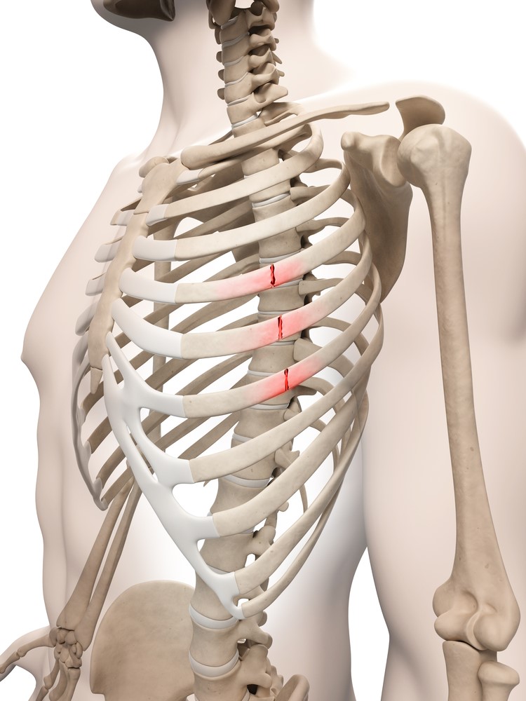 Common Upper Back and Chest Injuries - My Family Physio