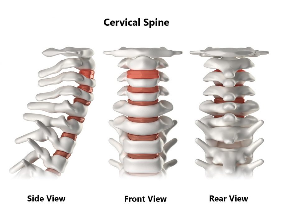 Common Neck Injuries My Family Physio