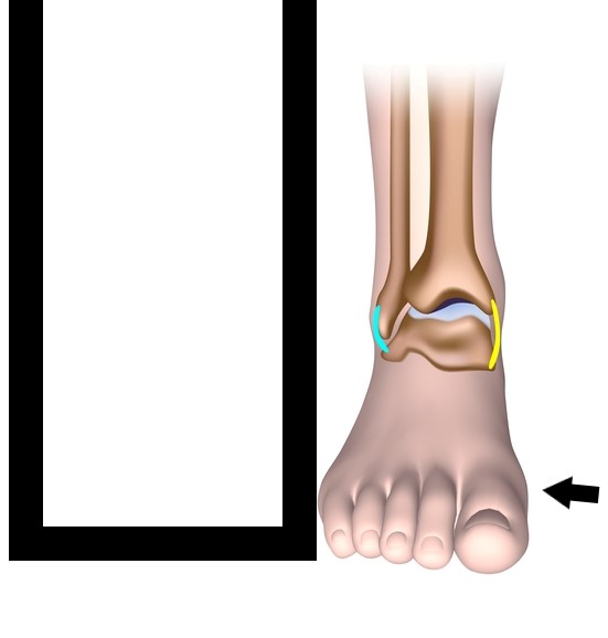 Ankle Sprain Physio Eastern Suburbs - Maroubra and Waverley