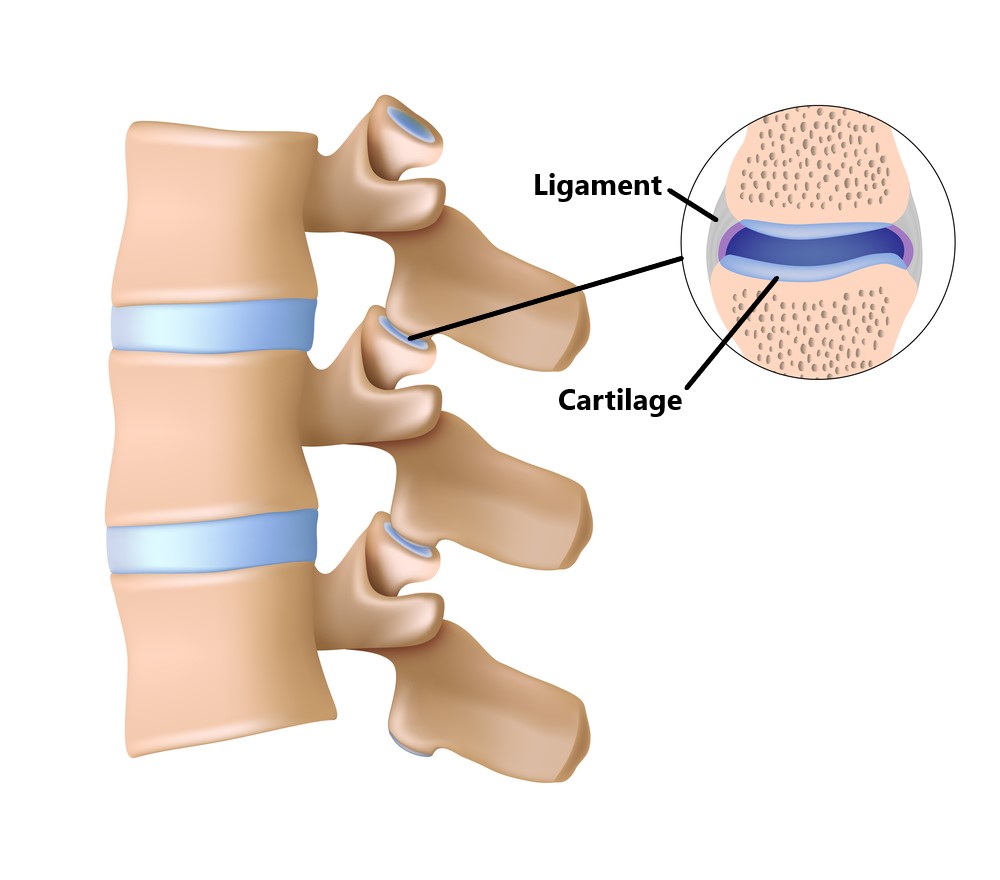 Facet Joint Injuries My Family Physio