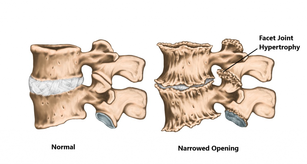 Facet Medical Definition