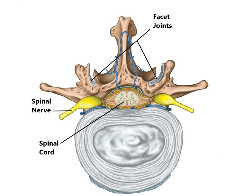 Facet Joint Injuries - My Family Physio