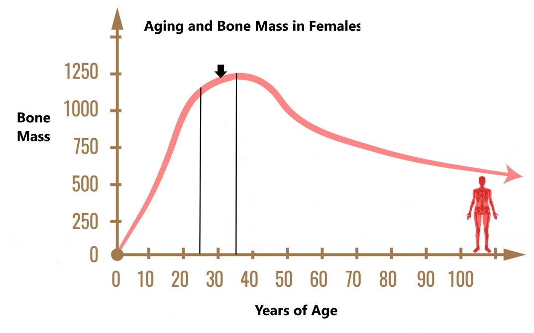 Osteoporosis - My Family Physio