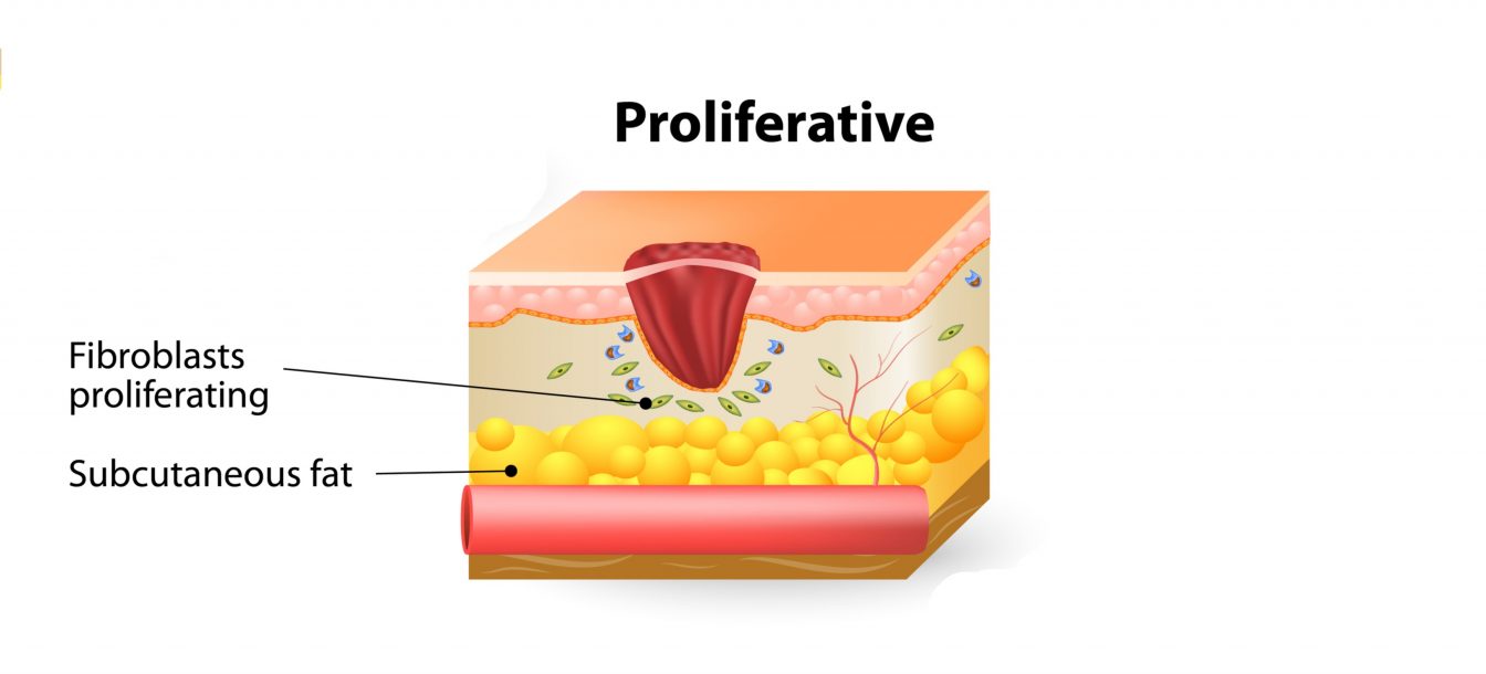 Tissue Healing - My Family Physio