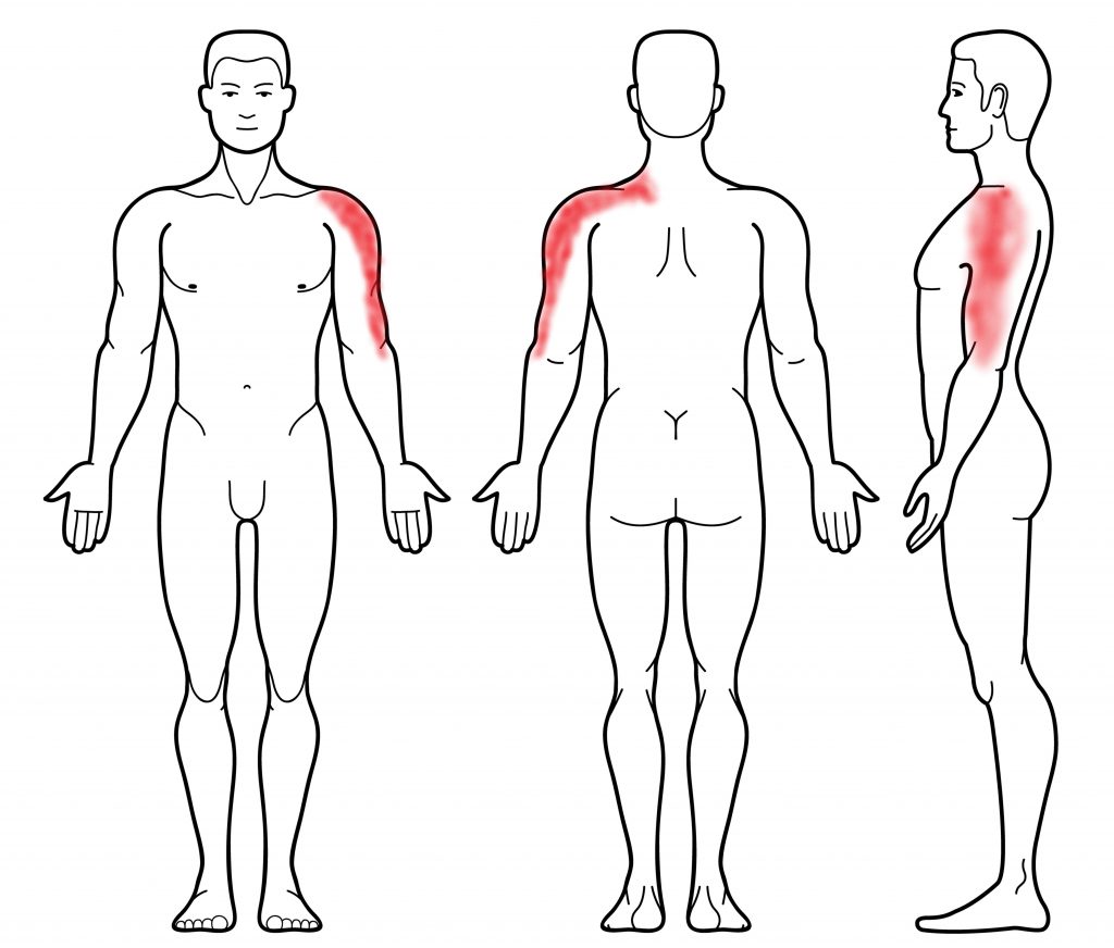 Rotator Cuff Injuries - My Family Physio